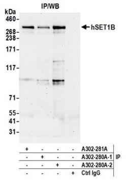 Detection of human hSET1B by western blot of immunoprecipitates.