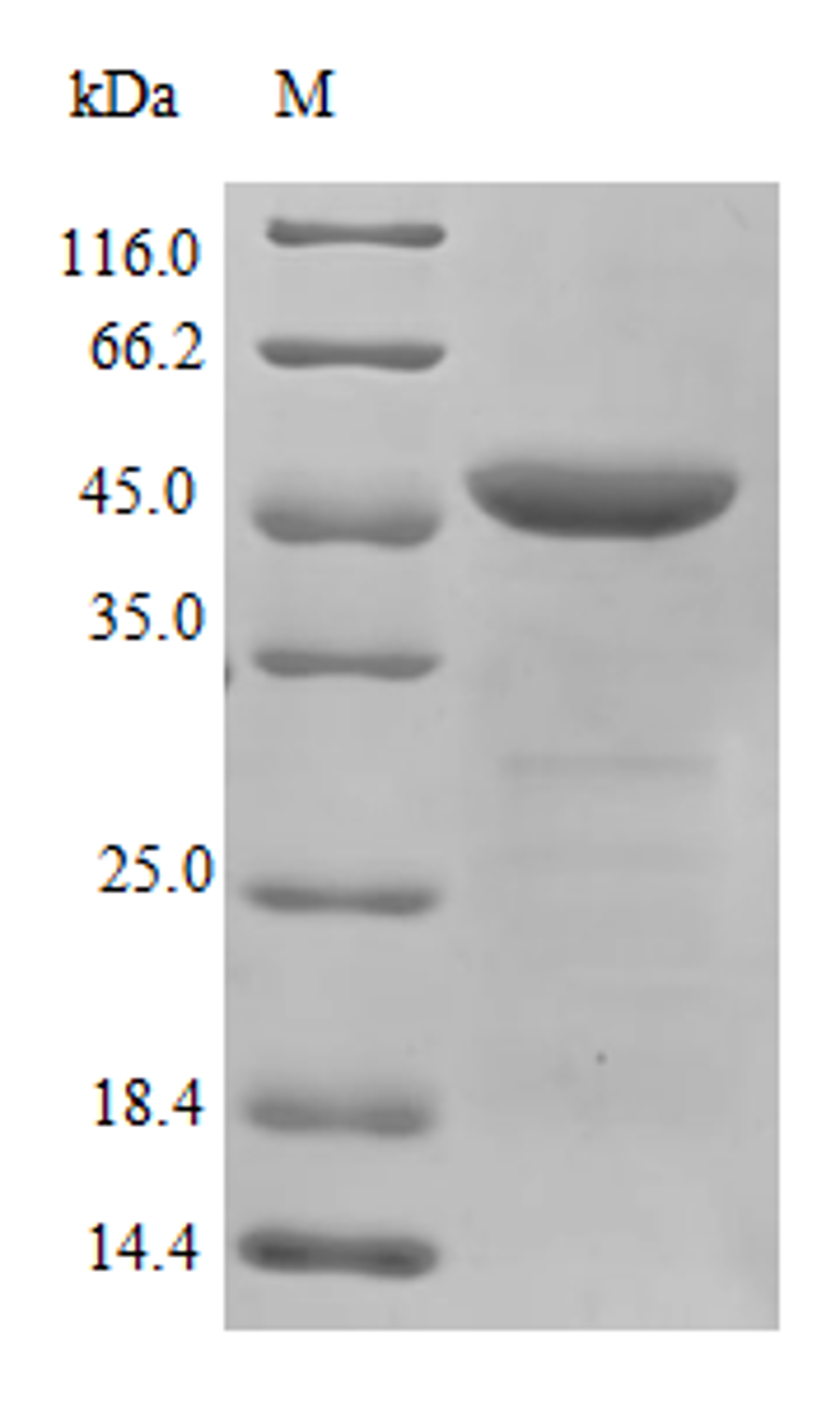 (Tris-Glycine gel) Discontinuous SDS-PAGE (reduced) with 5% enrichment gel and 15% separation gel.