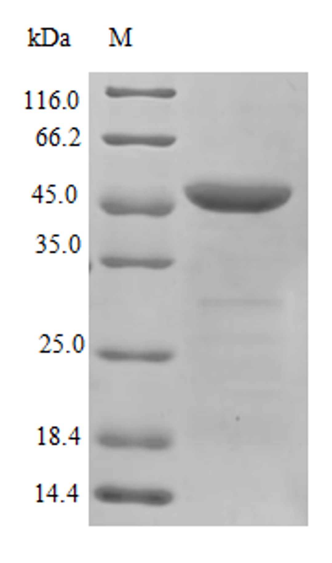 (Tris-Glycine gel) Discontinuous SDS-PAGE (reduced) with 5% enrichment gel and 15% separation gel.