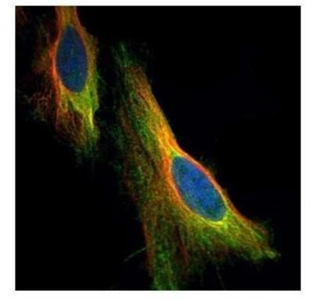 Immunocytochemistry/Immunofluorescence: ARC/NOL3 Antibody [NBP2-19561] - HeLa.