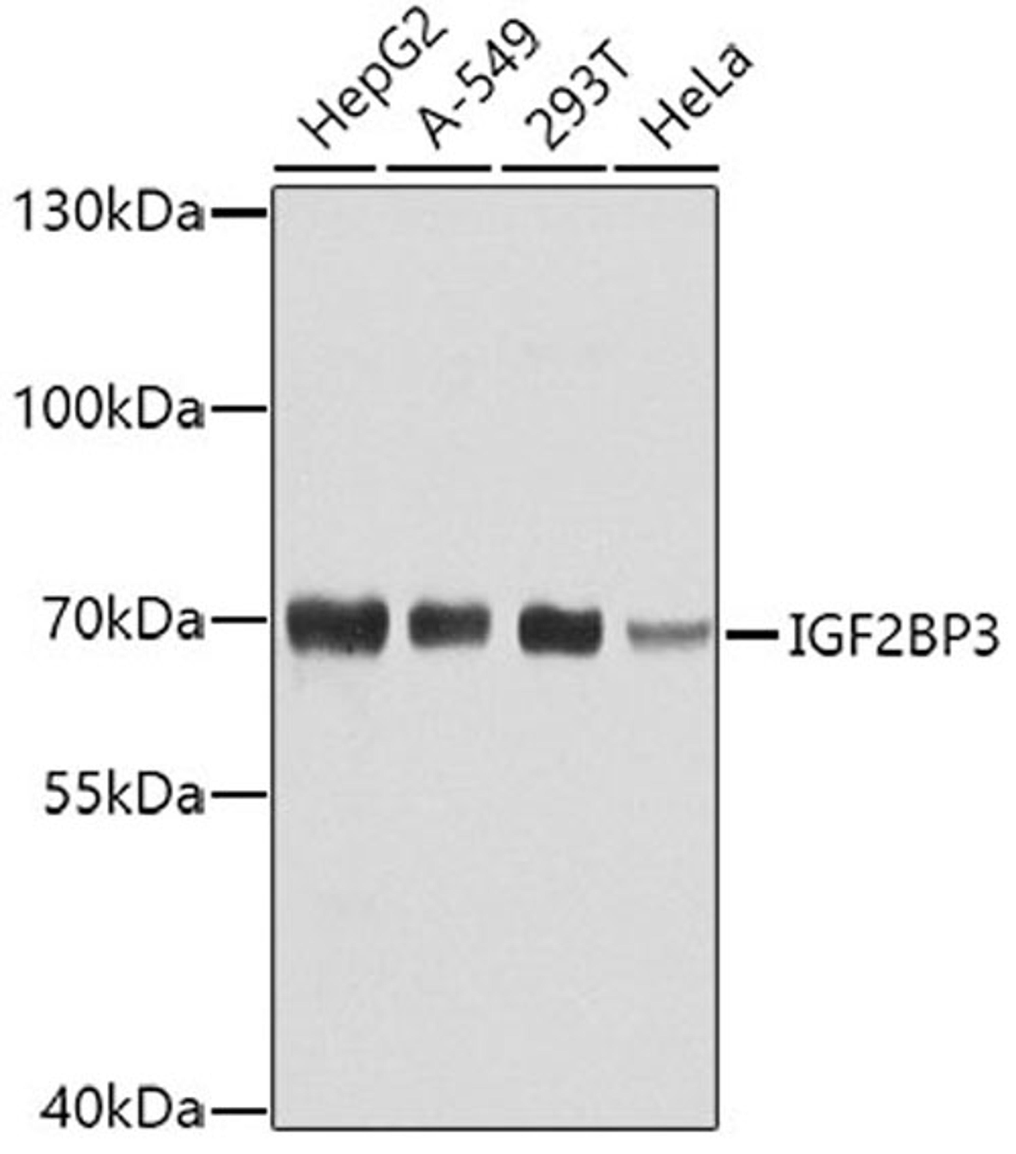 Western blot - IGF2BP3 antibody (A4444)