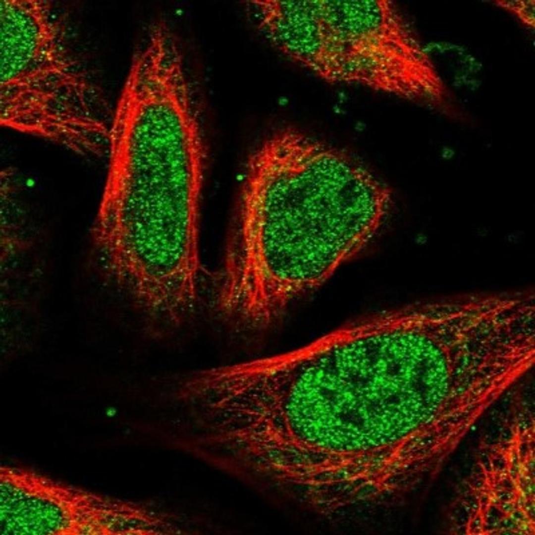 Immunocytochemistry/Immunofluorescence: UROS Antibody [NBP1-92565] - Staining of human cell line U-2 OS shows positivity in nucleus but not nucleoli & cytoplasm.