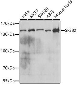 Western blot - SF3B2 antibody (A5875)