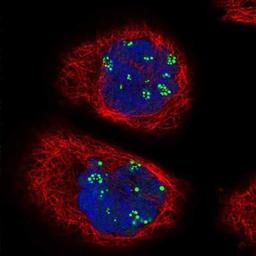 Immunocytochemistry/Immunofluorescence: Treacher Collins syndrome protein Antibody [NBP1-86909] - Staining of human cell line A-431 shows positivity in nucleoli.