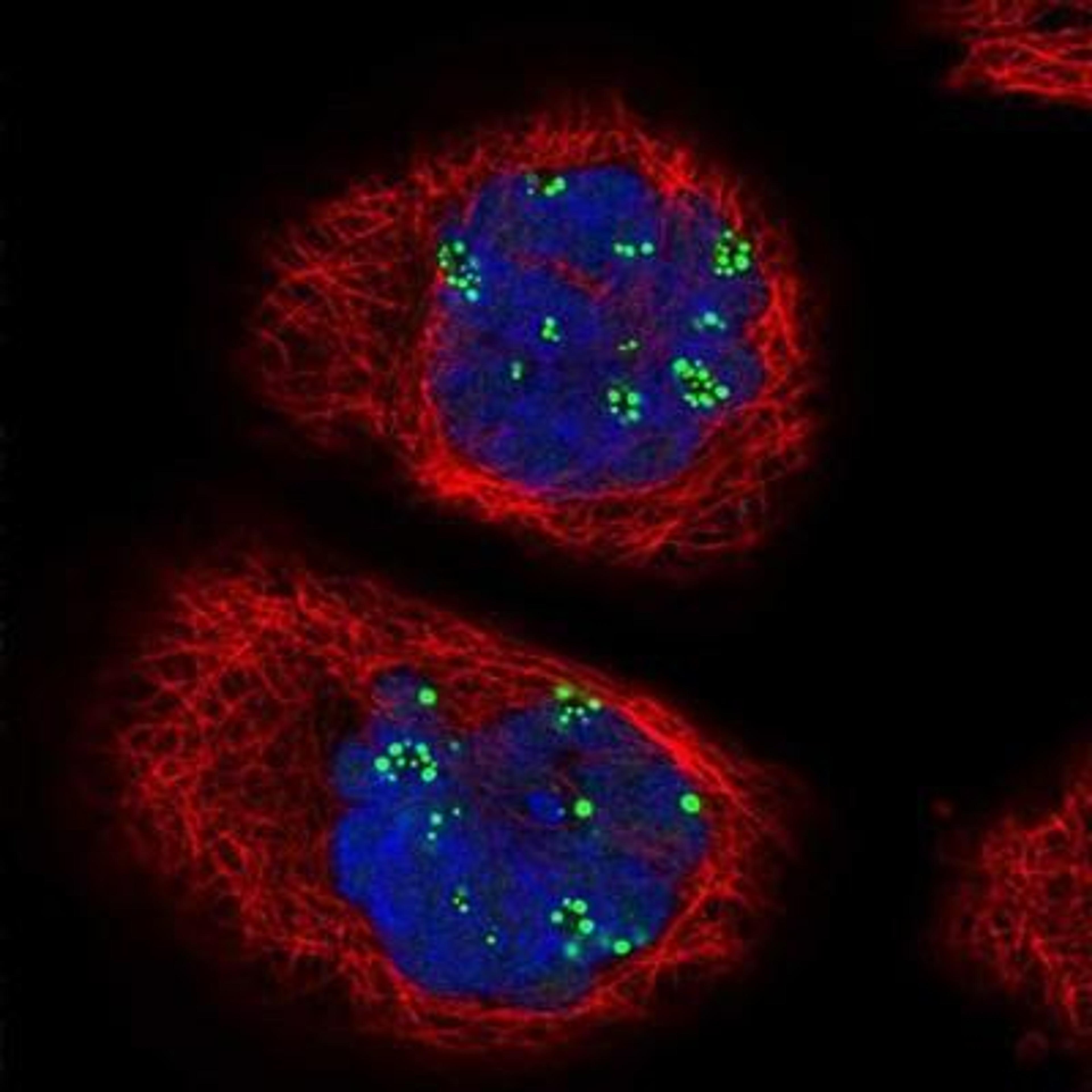 Immunocytochemistry/Immunofluorescence: Treacher Collins syndrome protein Antibody [NBP1-86909] - Staining of human cell line A-431 shows positivity in nucleoli.