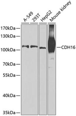 Western blot - CDH16 antibody (A7882)