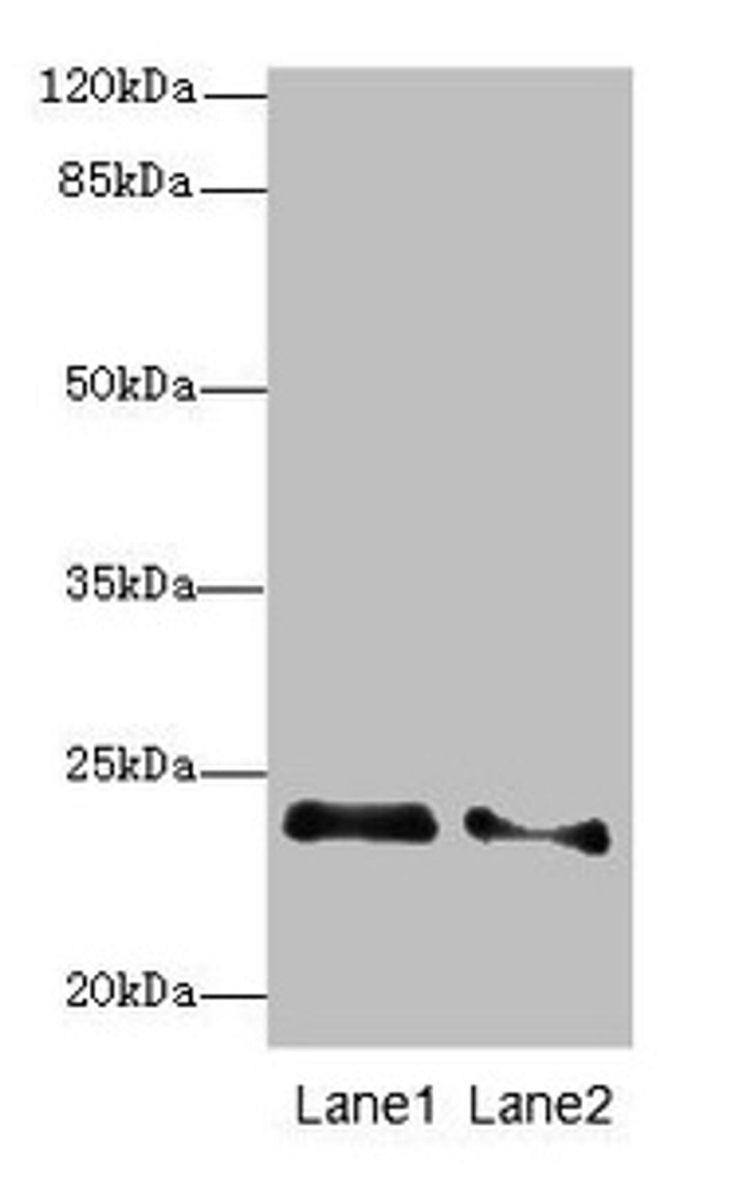 Western blot. All lanes: RRAS2 antibody at 2.66µg/ml. Lane 1: NIH/3T3 whole cell lysate. Lane 2: A431 whole cell lysate. Secondary. Goat polyclonal to rabbit IgG at 1/10000 dilution. Predicted band size: 24, 16, 20, 25 kDa. Observed band size: 24 kDa