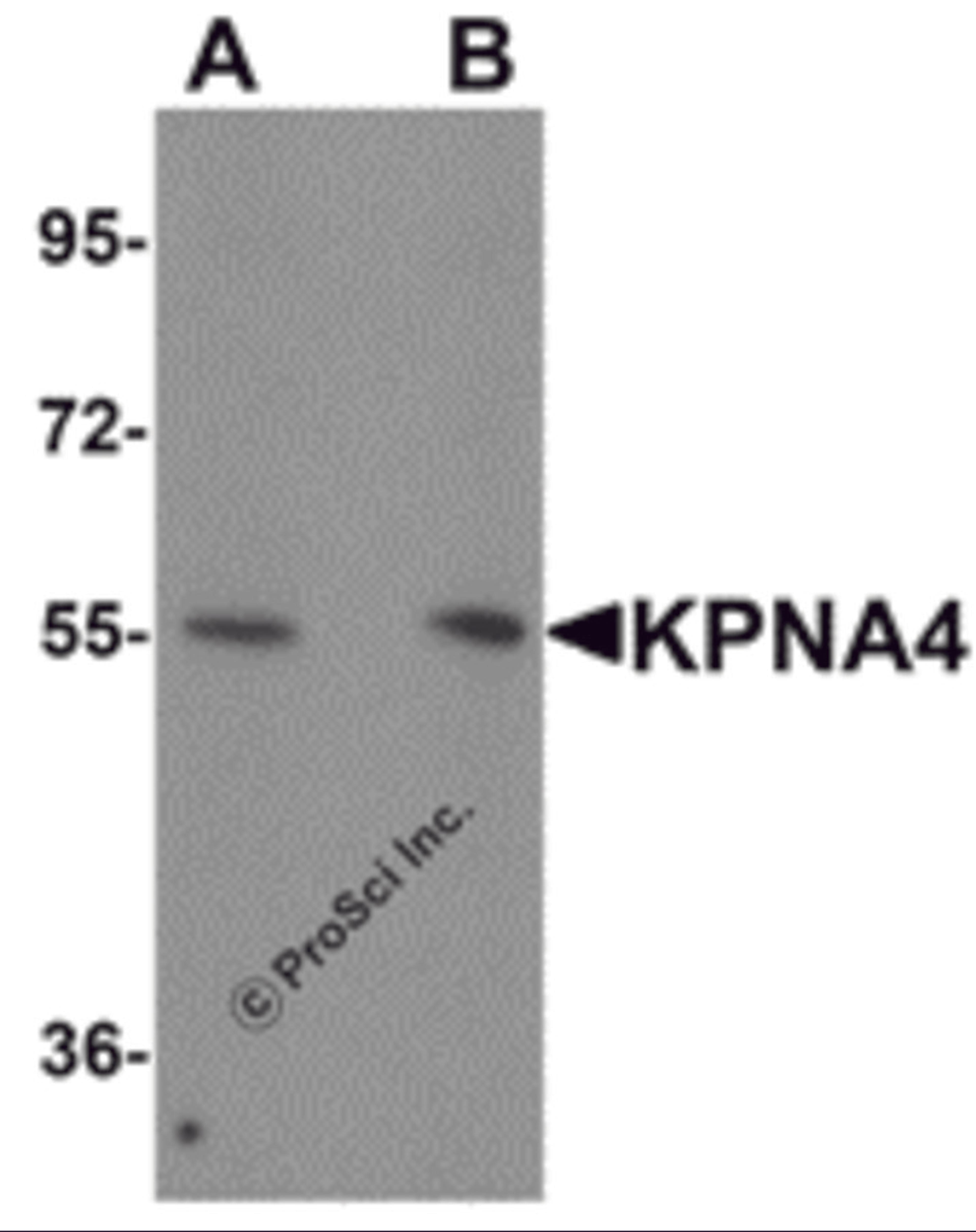 Western blot analysis of KPNA4 in HeLa cell lysate with KPNA4 antibody at (A) 0.5 and (B) 1 &#956;g/mL.