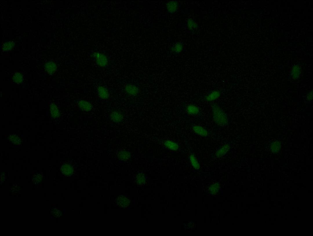 Immunofluorescence staining of MCF-7 with CSB-RA067358A0HU at 1:30, counter-stained with DAPI. The cells were fixed in 4% formaldehyde and blocked in 10% normal Goat Serum. The cells were then incubated with the antibody overnight at 4°C. The secondary antibody was Alexa Fluor 493-congugated AffiniPure Goat Anti-Rabbit IgG(H+L).
