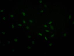 Immunofluorescence staining of MCF-7 with CSB-RA067358A0HU at 1:30, counter-stained with DAPI. The cells were fixed in 4% formaldehyde and blocked in 10% normal Goat Serum. The cells were then incubated with the antibody overnight at 4°C. The secondary antibody was Alexa Fluor 493-congugated AffiniPure Goat Anti-Rabbit IgG(H+L).