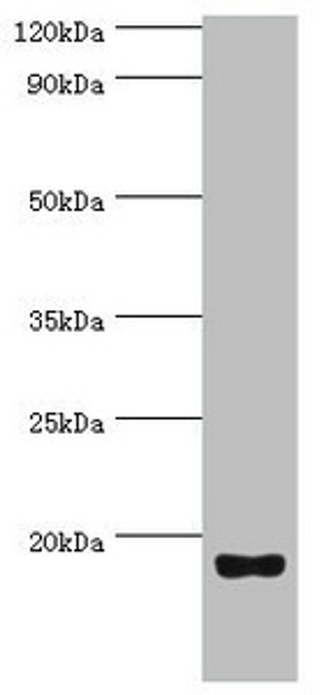 Western blot. All lanes: Urotensin-2 antibody at 8ug/ml + Rat brain tissue. Secondary. Goat polyclonal to rabbit IgG at 1/10000 dilution. Predicted band size: 15, 17 kDa. Observed band size: 15 kDa.