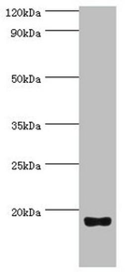 Western blot. All lanes: Urotensin-2 antibody at 8ug/ml + Rat brain tissue. Secondary. Goat polyclonal to rabbit IgG at 1/10000 dilution. Predicted band size: 15, 17 kDa. Observed band size: 15 kDa.