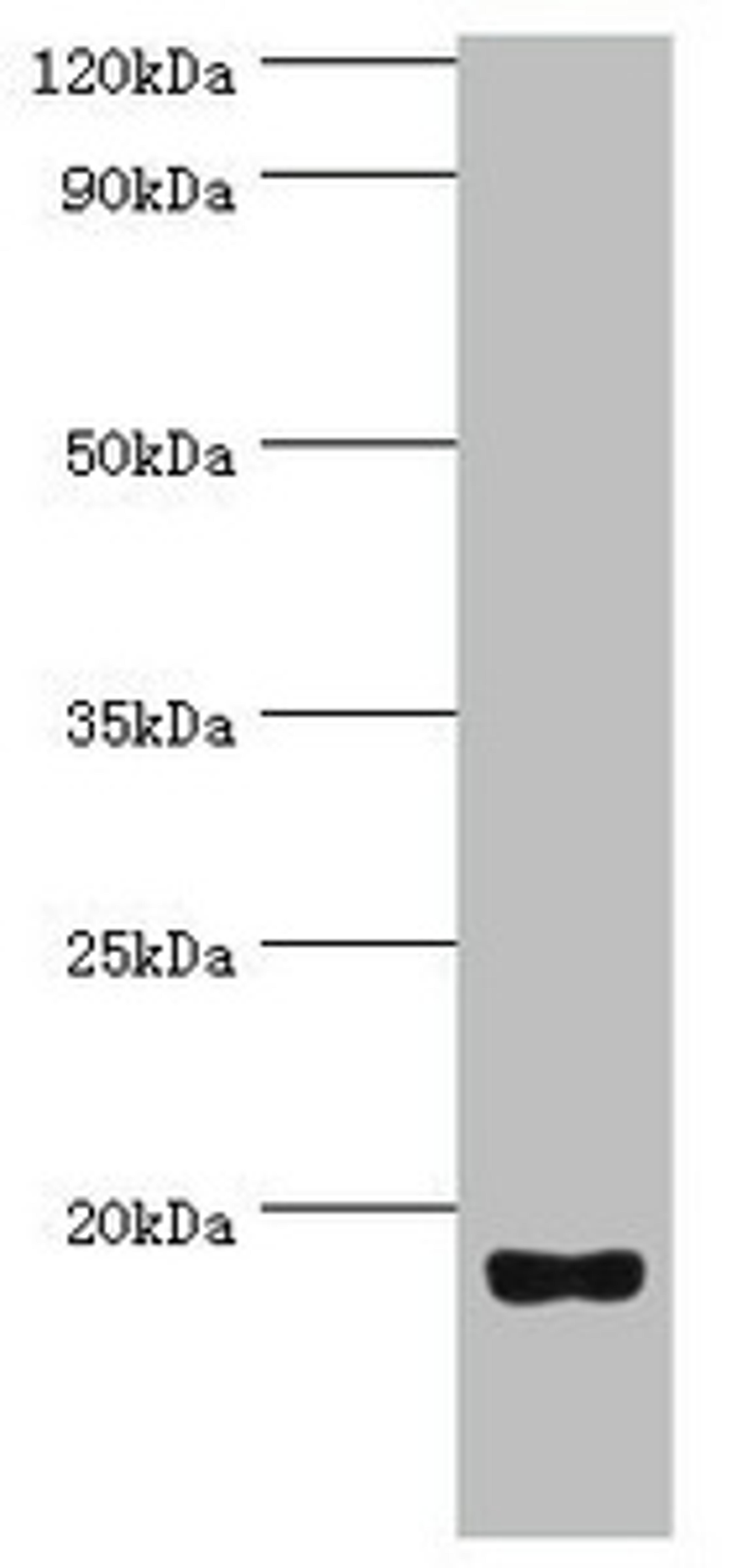 Western blot. All lanes: Urotensin-2 antibody at 8ug/ml + Rat brain tissue. Secondary. Goat polyclonal to rabbit IgG at 1/10000 dilution. Predicted band size: 15, 17 kDa. Observed band size: 15 kDa.