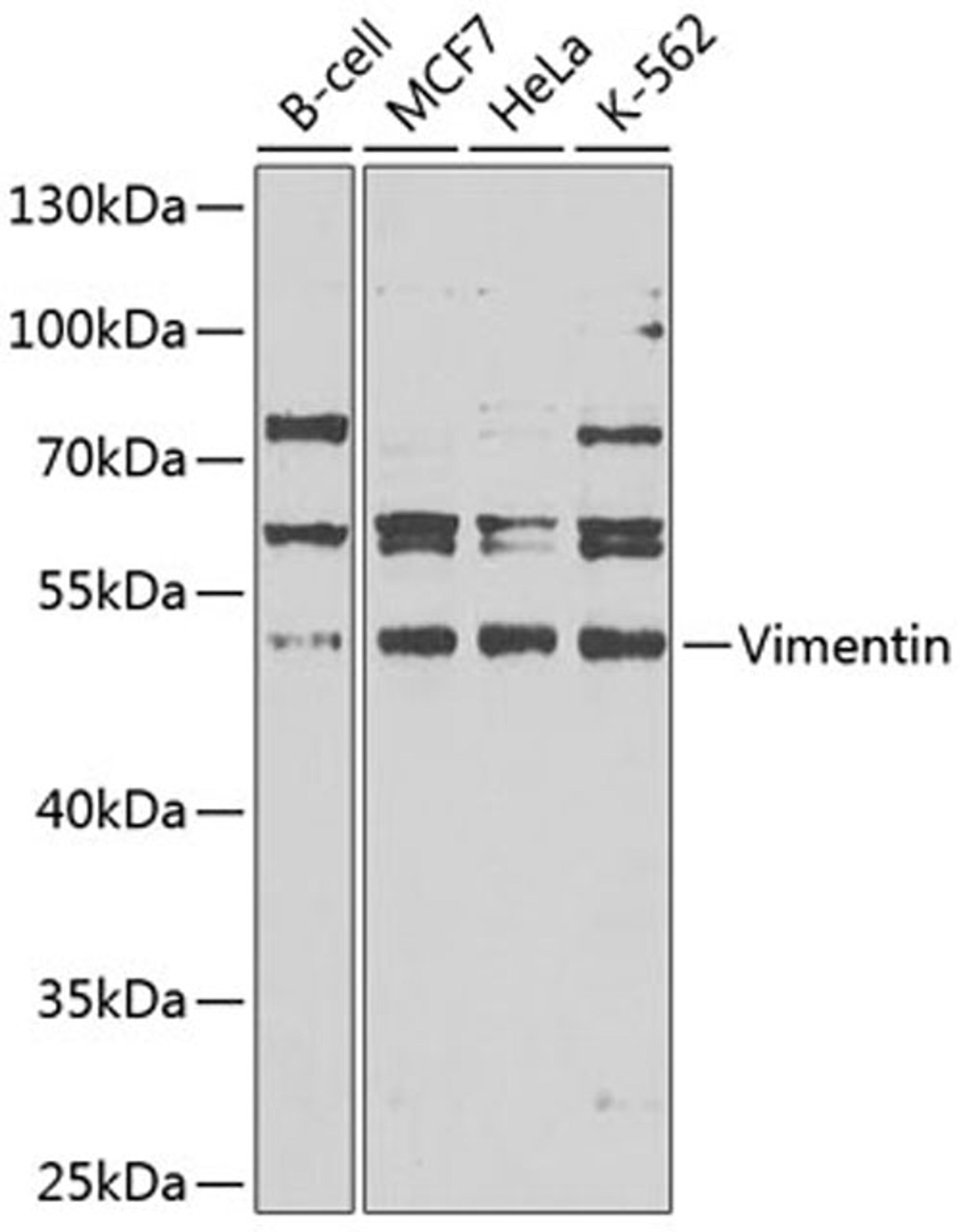 Western blot - Vimentin antibody (A11423)