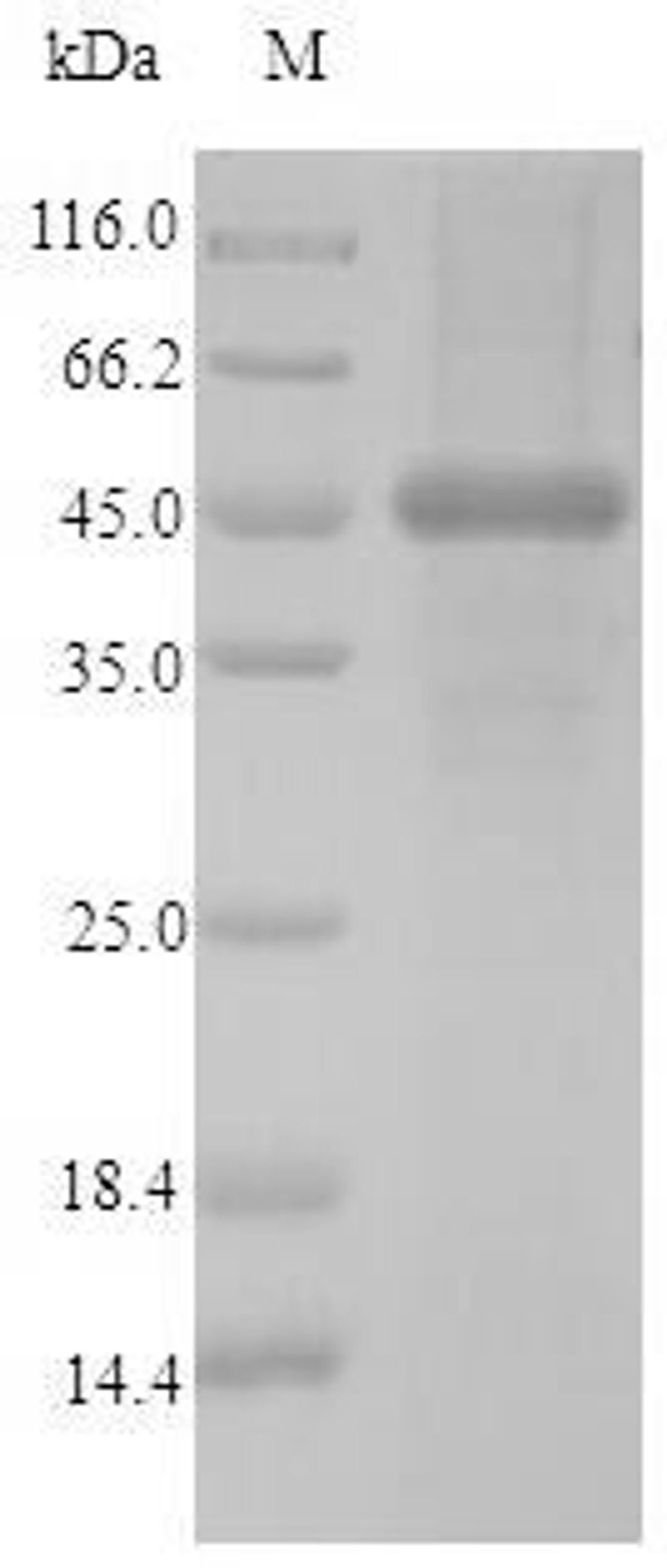 (Tris-Glycine gel) Discontinuous SDS-PAGE (reduced) with 5% enrichment gel and 15% separation gel.