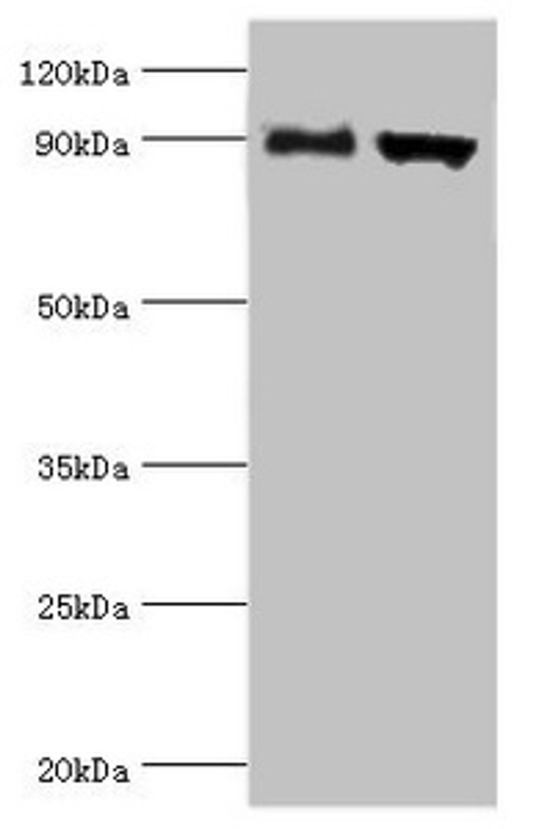 Western blot. All lanes: Disintegrin and metalloproteinase domain-containing protein 9 antibody at 2ug/ml. Lane 1: Mouse liver tissue. Lane 2: Mouse heart tissue. Secondary. Goat polyclonal to rabbit IgG at 1/10000 dilution. Predicted band size: 91, 73 kDa. Observed band size: 91 kDa. 
