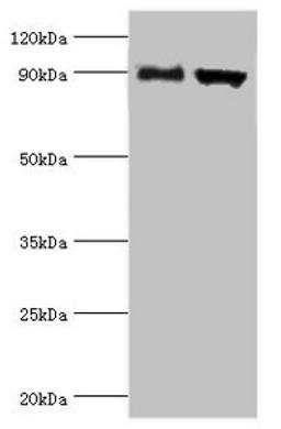 Western blot. All lanes: Disintegrin and metalloproteinase domain-containing protein 9 antibody at 2ug/ml. Lane 1: Mouse liver tissue. Lane 2: Mouse heart tissue. Secondary. Goat polyclonal to rabbit IgG at 1/10000 dilution. Predicted band size: 91, 73 kDa. Observed band size: 91 kDa. 