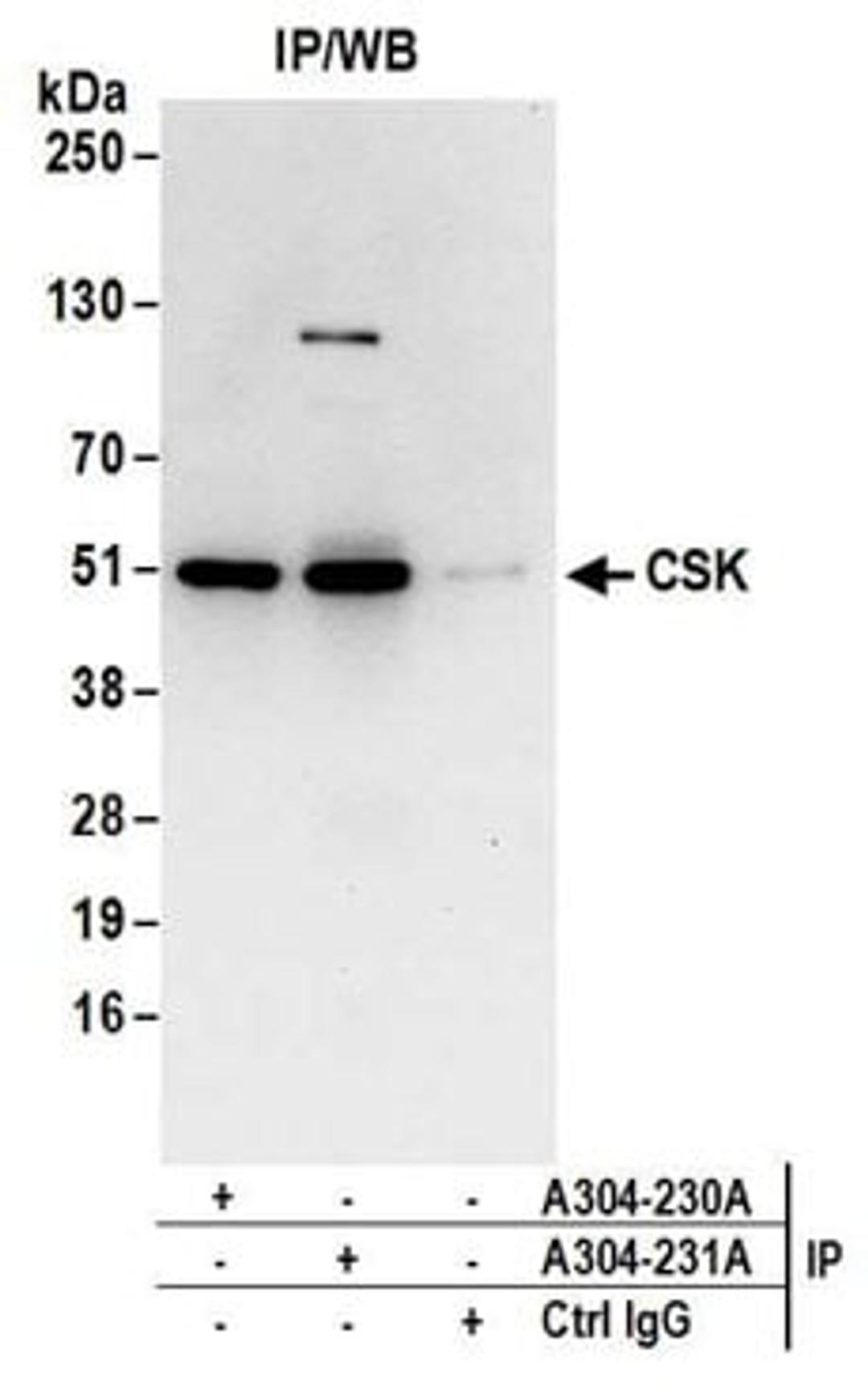 Detection of human CSK by western blot of immunoprecipitates.