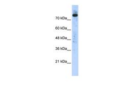 Antibody used in WB on Transfected 293T at 0.2-1 ug/ml.