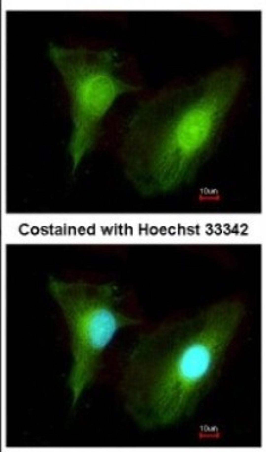 Immunocytochemistry/Immunofluorescence: SMYD2 Antibody [NBP2-20429] - Immunofluorescence analysis of methanol-fixed HeLa, using antibody at 1:200 dilution.