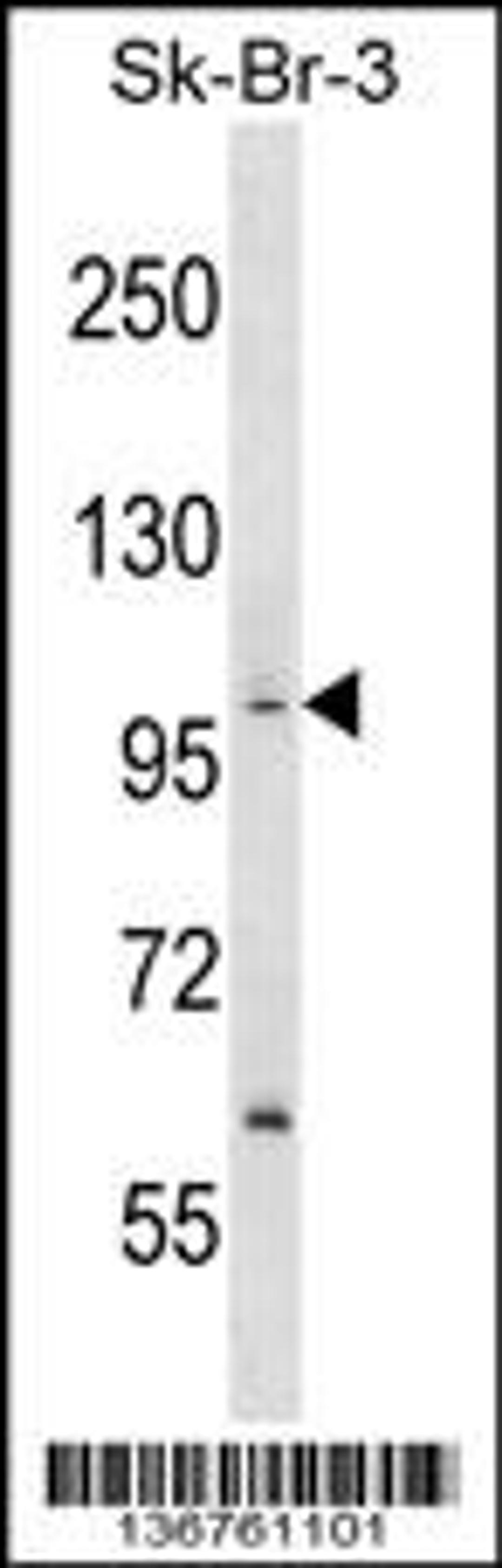 Western blot analysis in SK-BR-3 cell line lysates (35ug/lane).