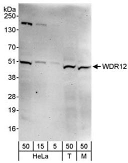 Detection of human and mouse WDR12 by western blot.