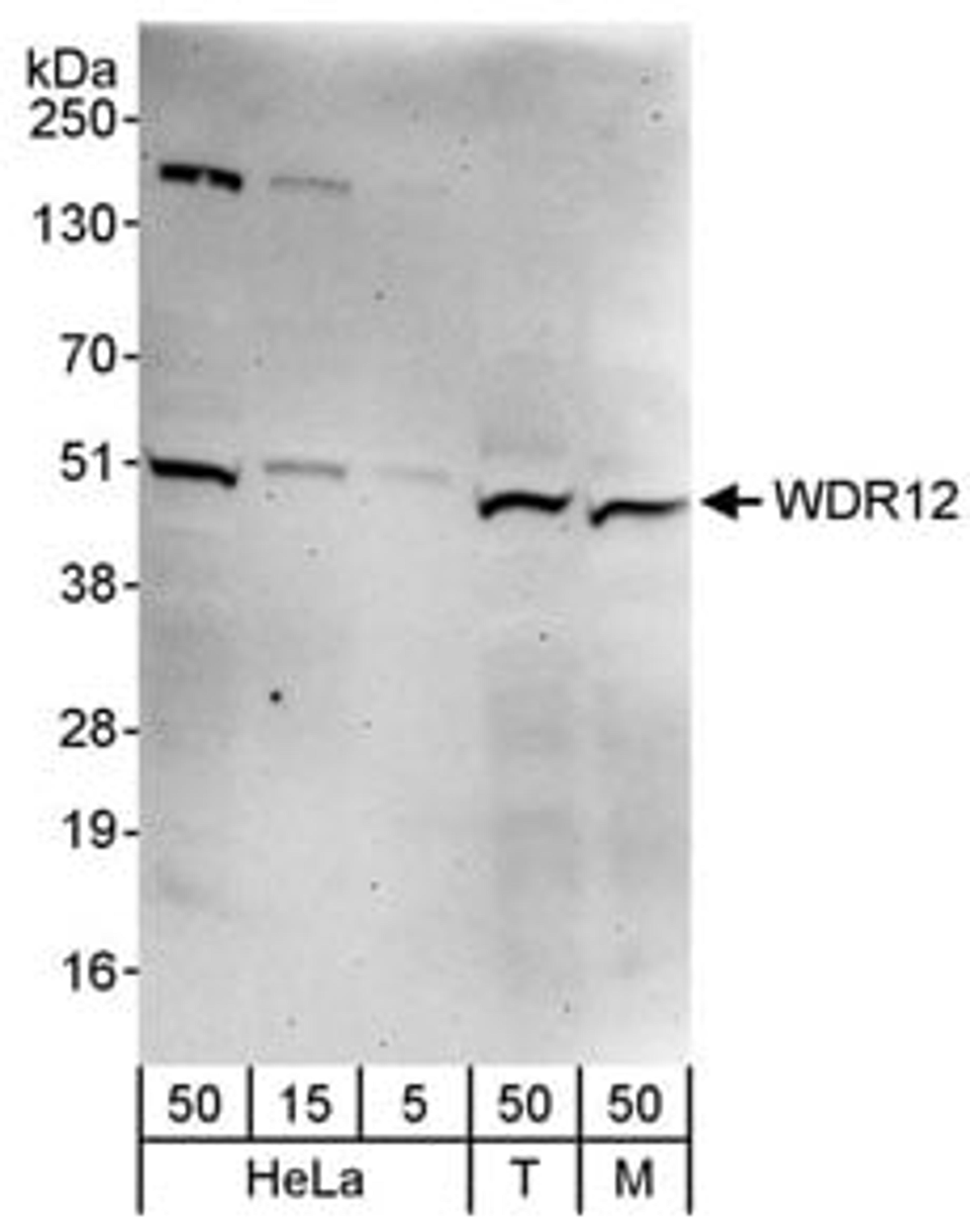 Detection of human and mouse WDR12 by western blot.