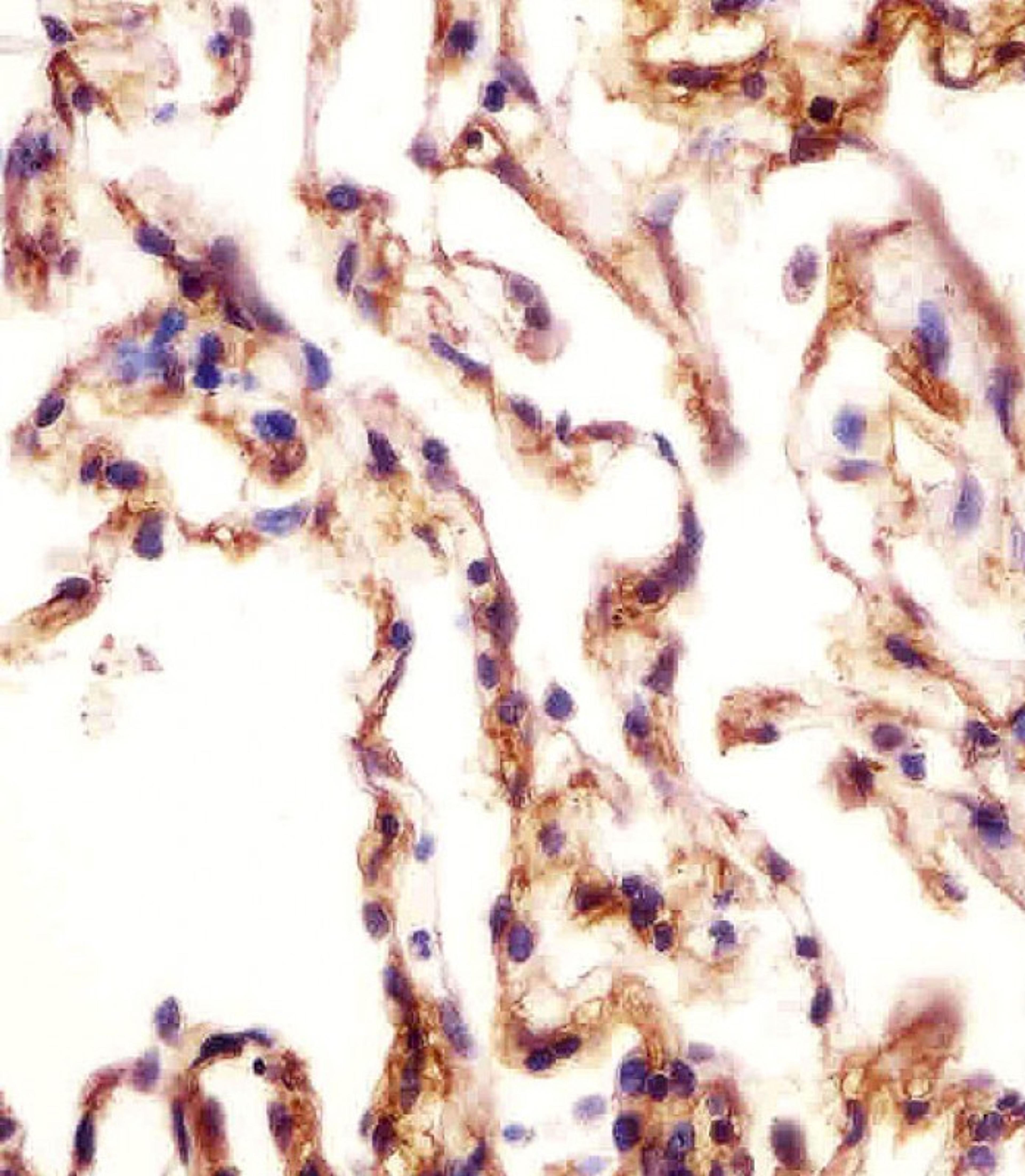 Antibody staining AOC3 in human lung tissue sections by Immunohistochemistry (IHC-P - paraformaldehyde-fixed, paraffin-embedded sections).