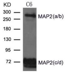 Western blot analysis of extract from Rat brain and Mouse brain Tissue using MAP2 Antibody.