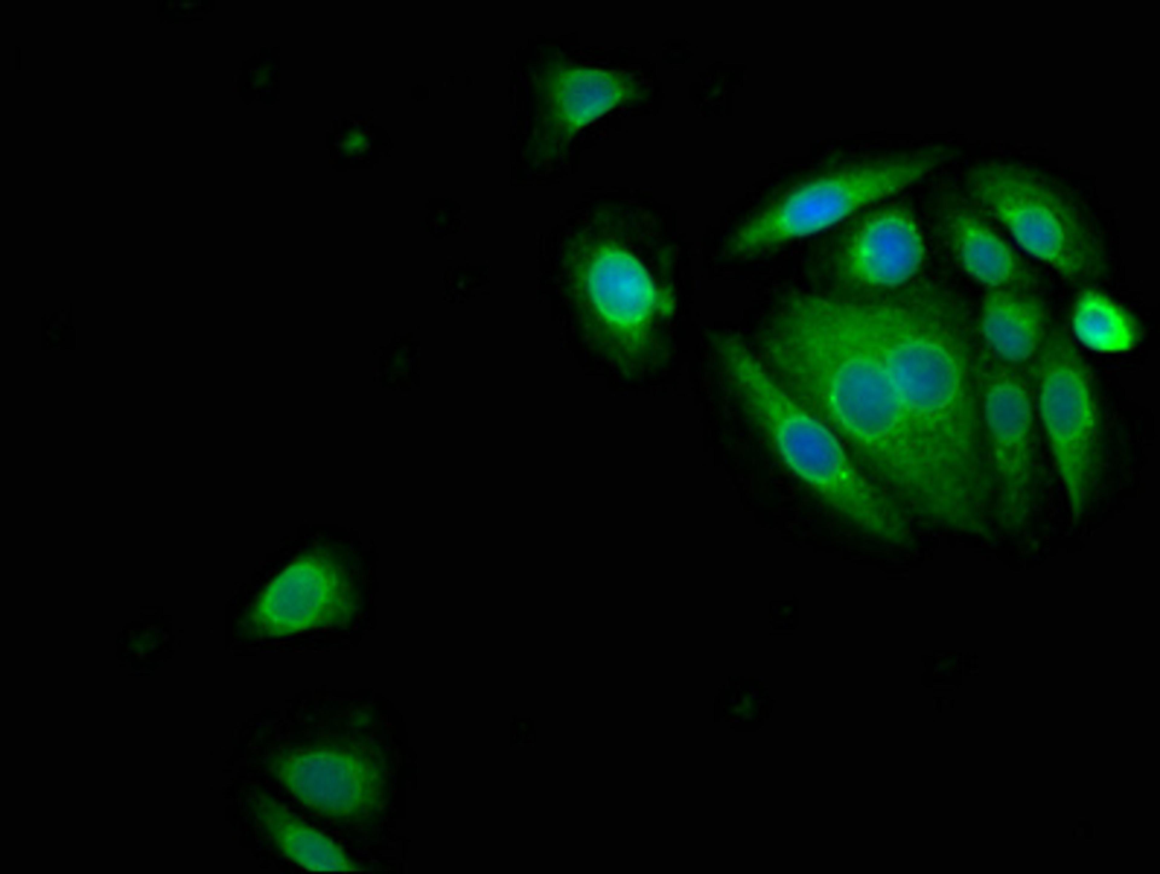 Immunofluorescence staining of A549 cells with CSB-PA11275A0Rb at 1:150, counter-stained with DAPI. The cells were fixed in 4% formaldehyde, permeabilized using 0.2% Triton X-100 and blocked in 10% normal Goat Serum. The cells were then incubated with the antibody overnight at 4°C.The secondary antibody was Alexa Fluor 488-congugated AffiniPure Goat Anti-Rabbit IgG(H+L).