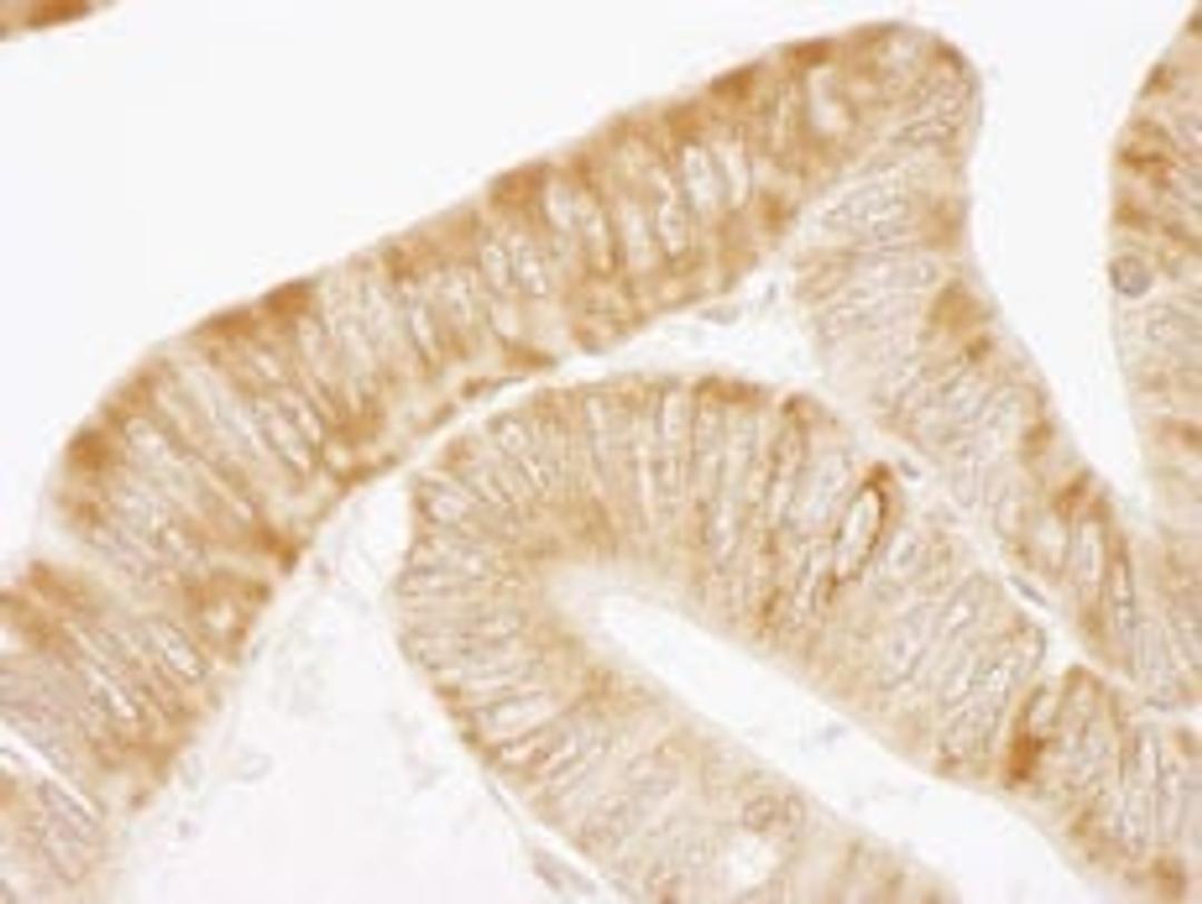 Detection of human ARHGEF5 by immunohistochemistry.