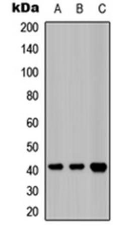 Western blot analysis of HeLa (Lane 1), A549 (Lane 2), mouse heart (Lane 3) whole cell lysates using EDG2 antibody