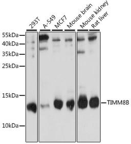 Western blot - TIMM8B antibody (A15814)