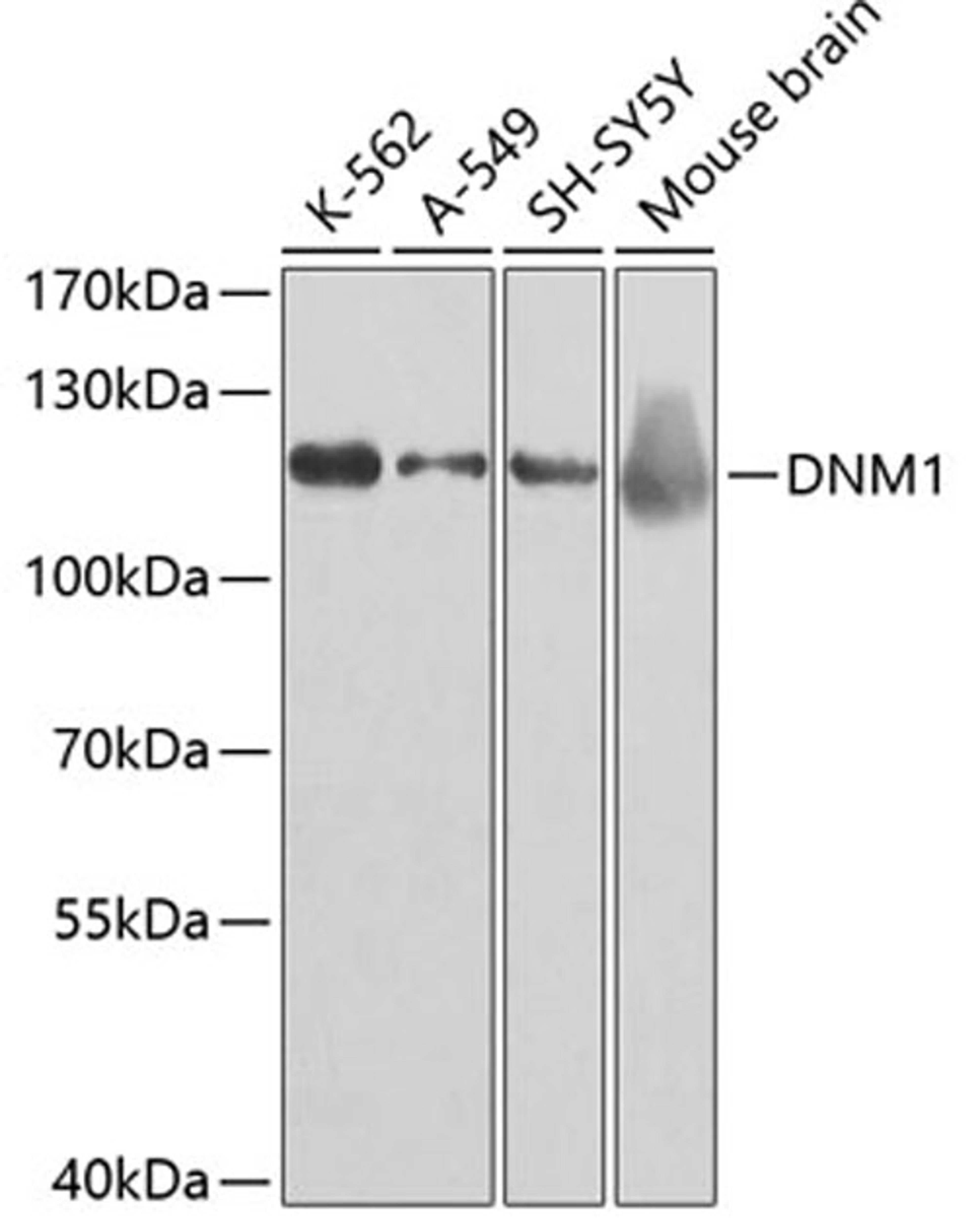 Western blot - DNM1 antibody (A2902)