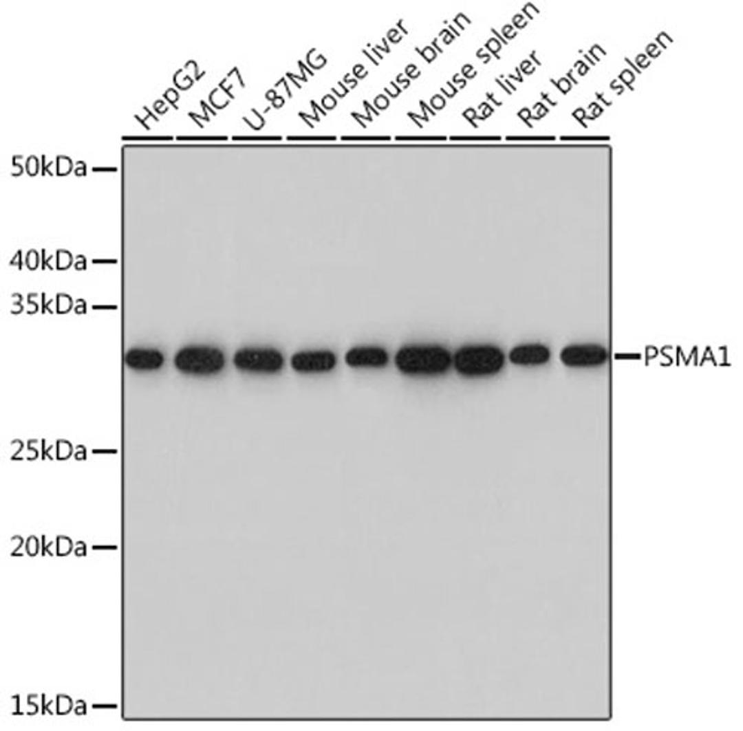 Western blot - PSMA1 Rabbit mAb (A3460)