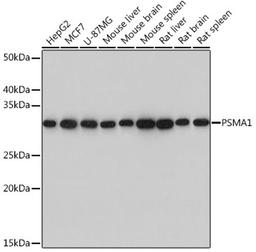 Western blot - PSMA1 Rabbit mAb (A3460)