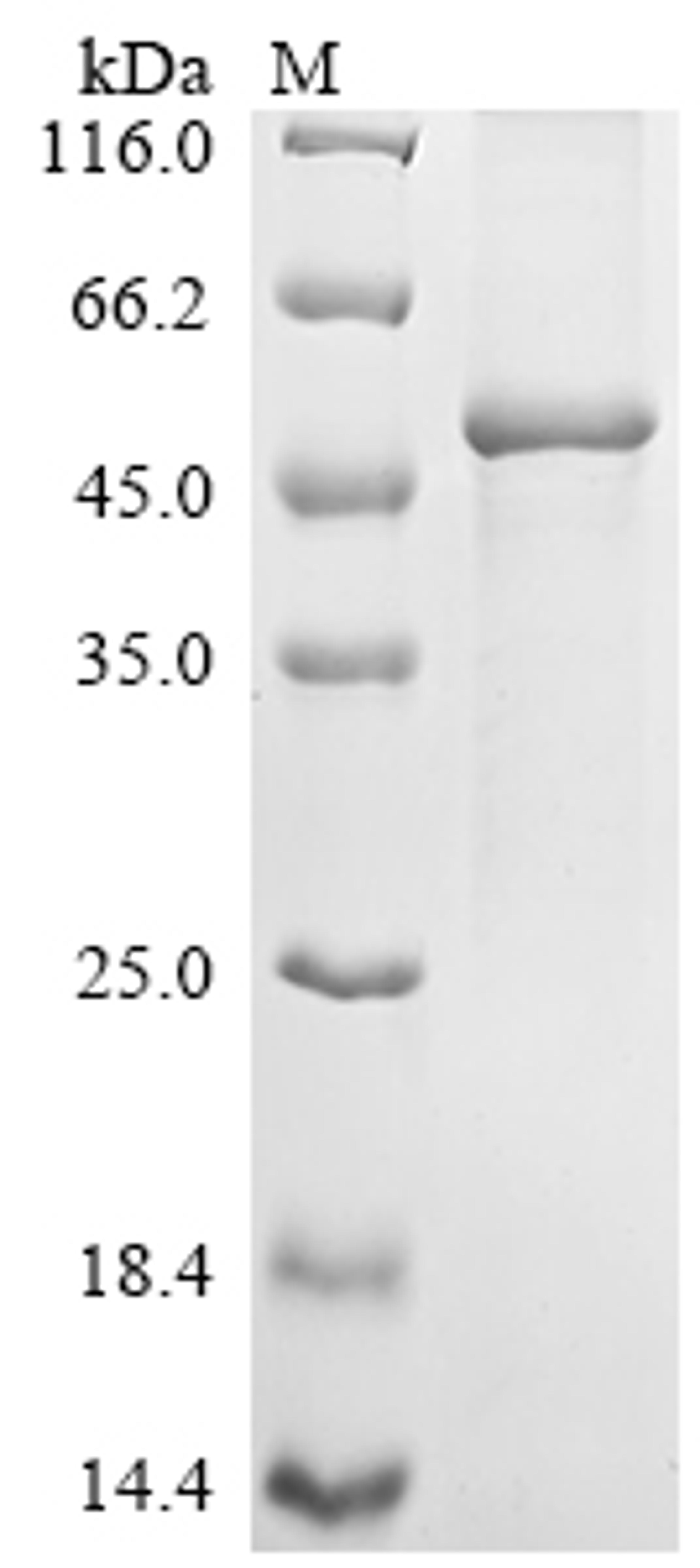 (Tris-Glycine gel) Discontinuous SDS-PAGE (reduced) with 5% enrichment gel and 15% separation gel.
