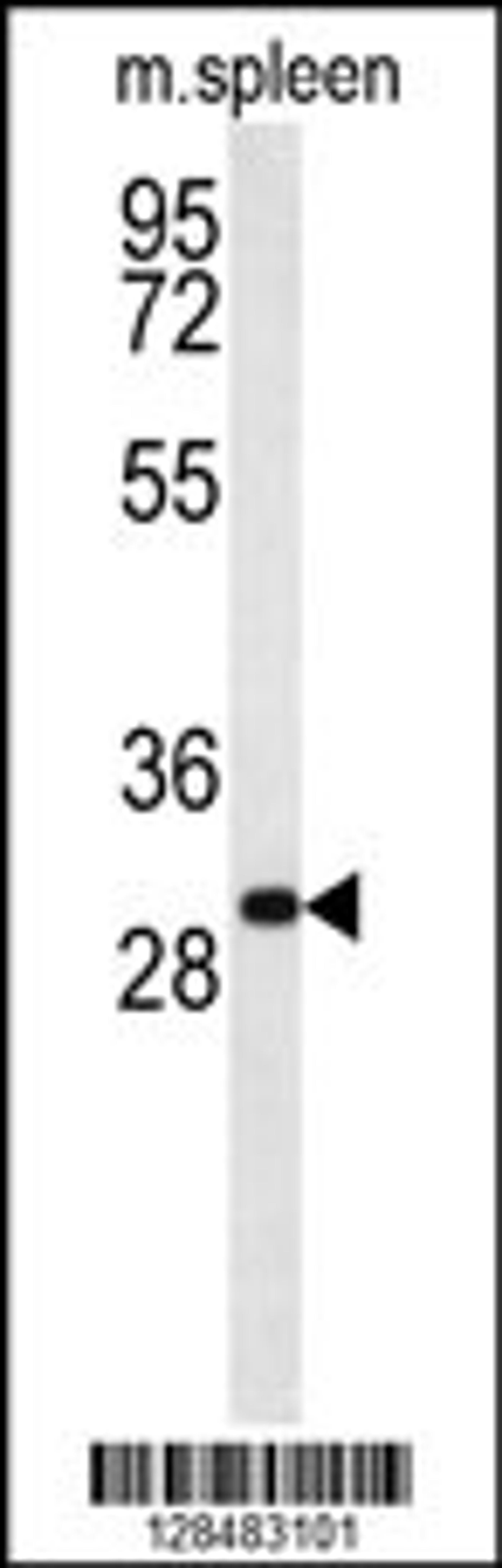 Western blot analysis in mouse spleen tissue lysates (35ug/lane).