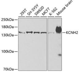 Western blot - KCNH2 antibody (A2968)