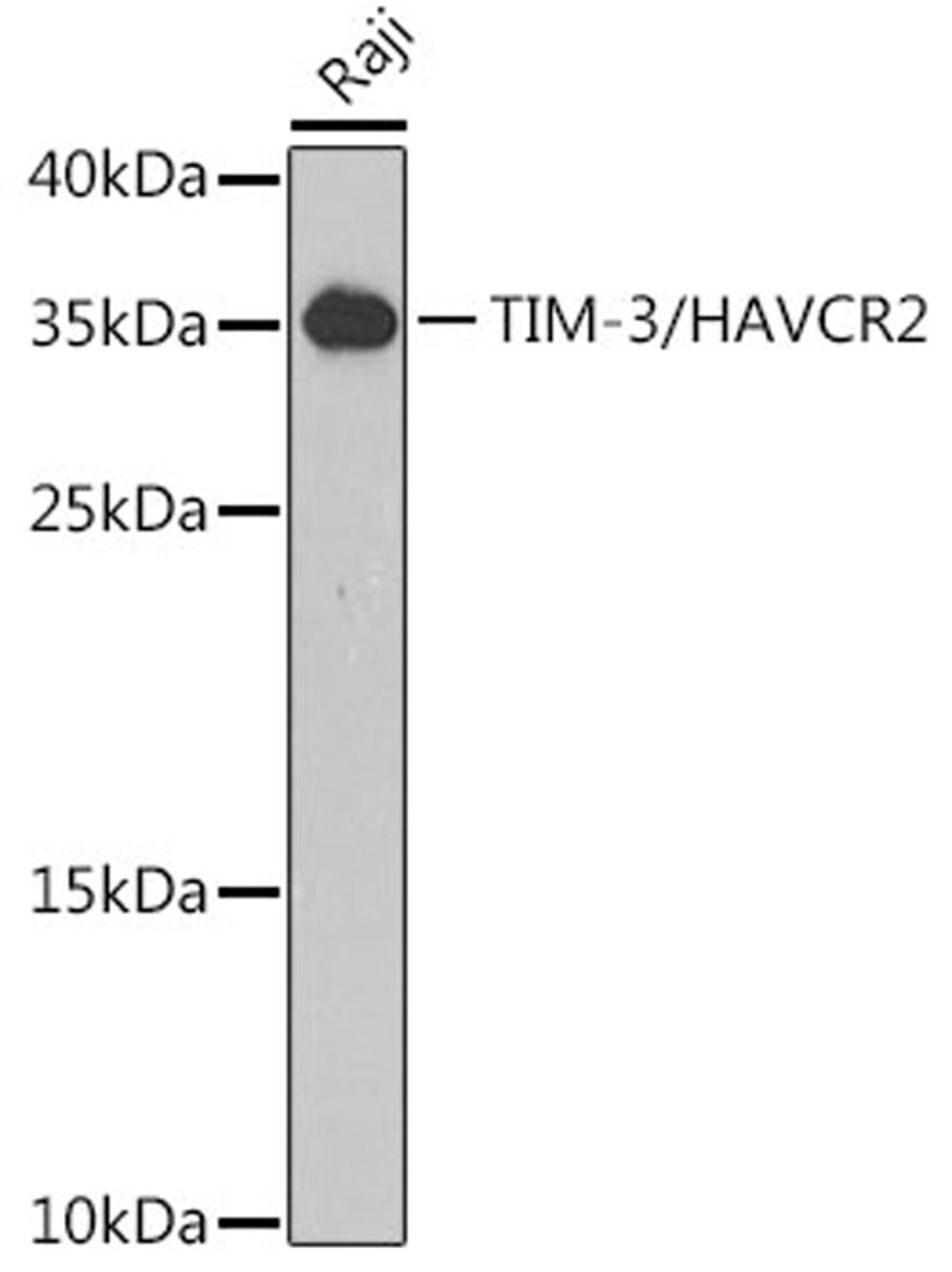 Western blot - TIM-3/HAVCR2 antibody (A13444)