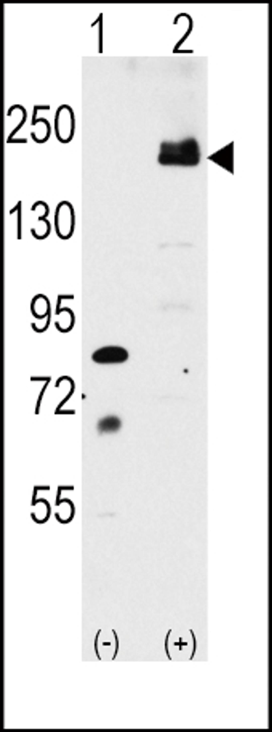 Western blot analysis of LRP6 using rabbit polyclonal LRP6 Antibody (C-term T1546) using 293 cell lysates (2 ug/lane) either nontransfected (Lane 1) or transiently transfected with the LRP6 gene (Lane 2).