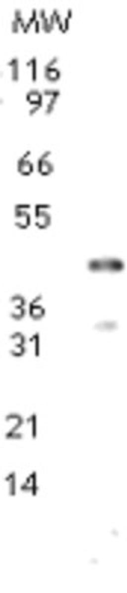 Western Blot: Dnmt2 Antibody [NB200-616] - Western blot analysis for Dnmt2a using NB200-616 at 2 ug/ml dilution against 10 ug of mouse testis lysates. A protein band of approximate mol. wt. of 42 kDa is detected.