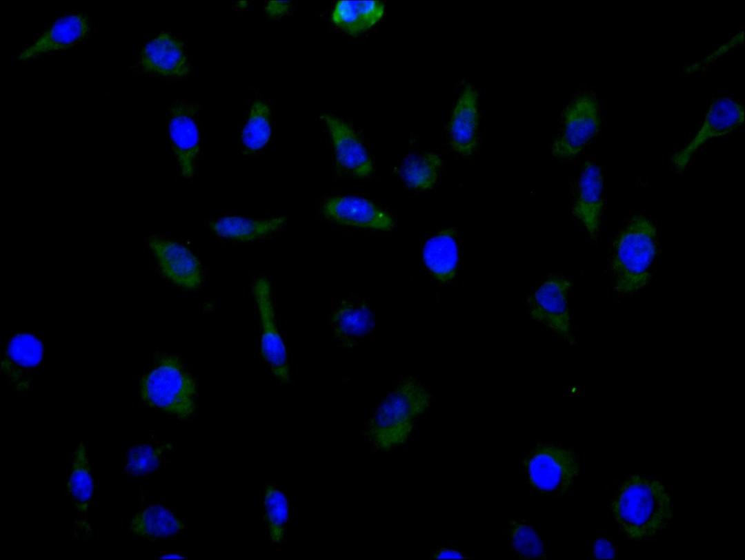 Immunofluorescence staining of MCF cell with CSB-RA620892MA1HU at 1:100, counter-stained with DAPI. The cells were fixed in 4% formaldehyde and blocked in 10% normal Goat Serum. The cells were then incubated with the antibody overnight at 4C. The secondary antibody was FITC-conjugated AffiniPure Goat Anti-Human IgG(H+L).
