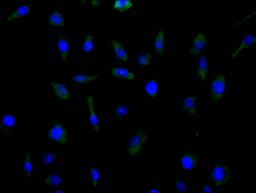Immunofluorescence staining of MCF cell with CSB-RA620892MA1HU at 1:100, counter-stained with DAPI. The cells were fixed in 4% formaldehyde and blocked in 10% normal Goat Serum. The cells were then incubated with the antibody overnight at 4C. The secondary antibody was FITC-conjugated AffiniPure Goat Anti-Human IgG(H+L).