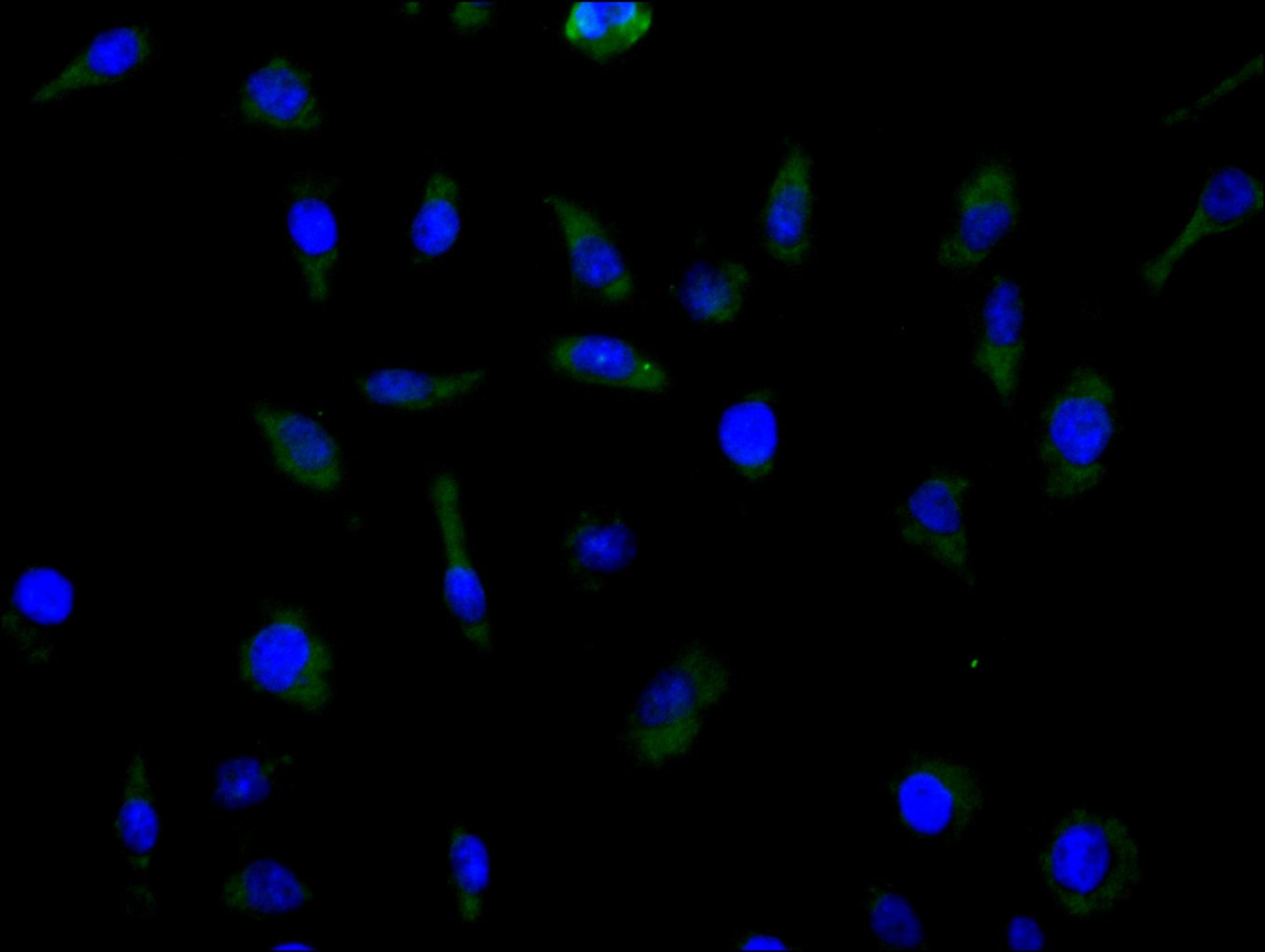 Immunofluorescence staining of MCF cell with CSB-RA620892MA1HU at 1:100, counter-stained with DAPI. The cells were fixed in 4% formaldehyde and blocked in 10% normal Goat Serum. The cells were then incubated with the antibody overnight at 4C. The secondary antibody was FITC-conjugated AffiniPure Goat Anti-Human IgG(H+L).