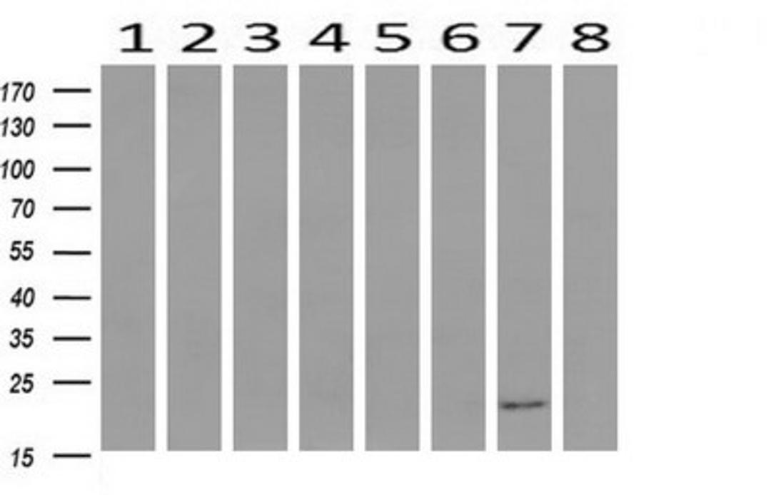 Western Blot: vH RAS Antibody (1D9) [NBP2-45745] - Analysis of extracts (10ug) from 8 Human tissue by using HRAS monoclonal antibody at 1:200 (1: Testis; 2: Uterus; 3: Breast; 4: Brain; 5: Liver; 6: Ovary; 7: Thyroid gland; 8: Colon).