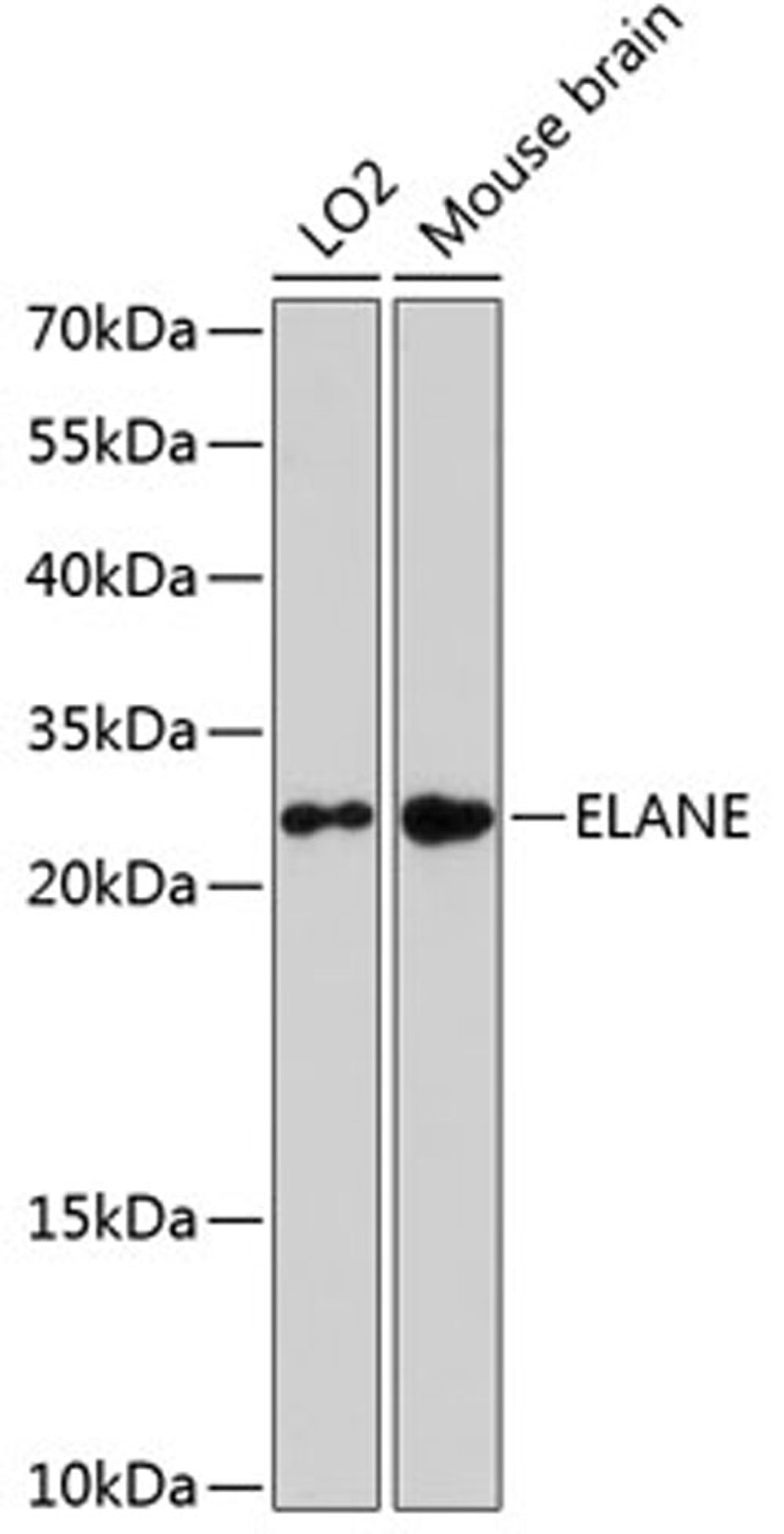 Western blot - ELANE antibody (A13015)