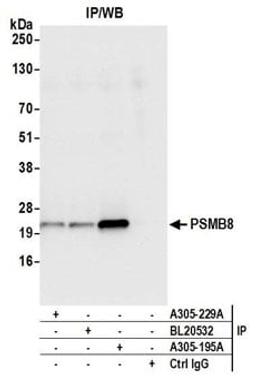 Detection of human PSMB8 by western blot of immunoprecipitates.