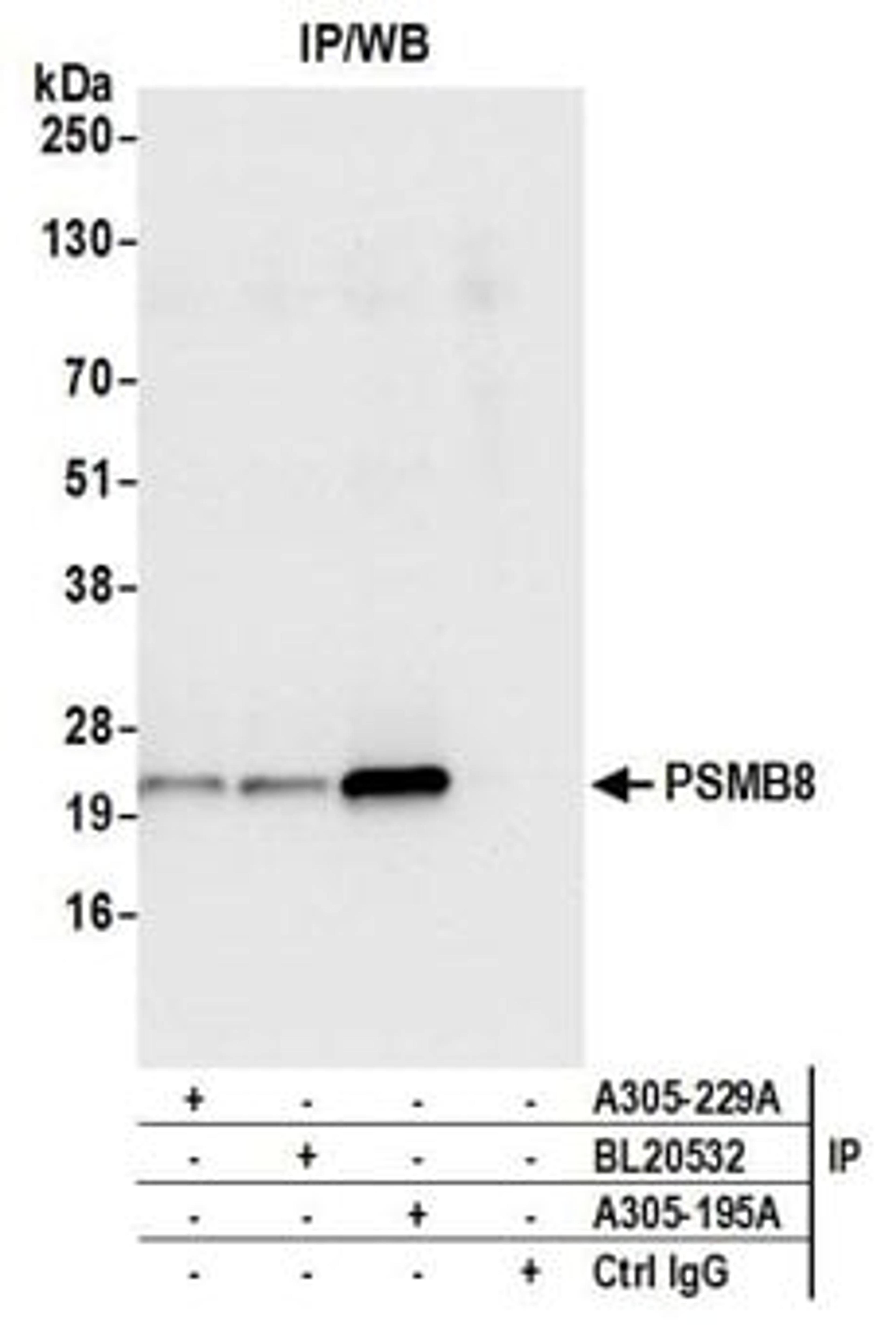 Detection of human PSMB8 by western blot of immunoprecipitates.