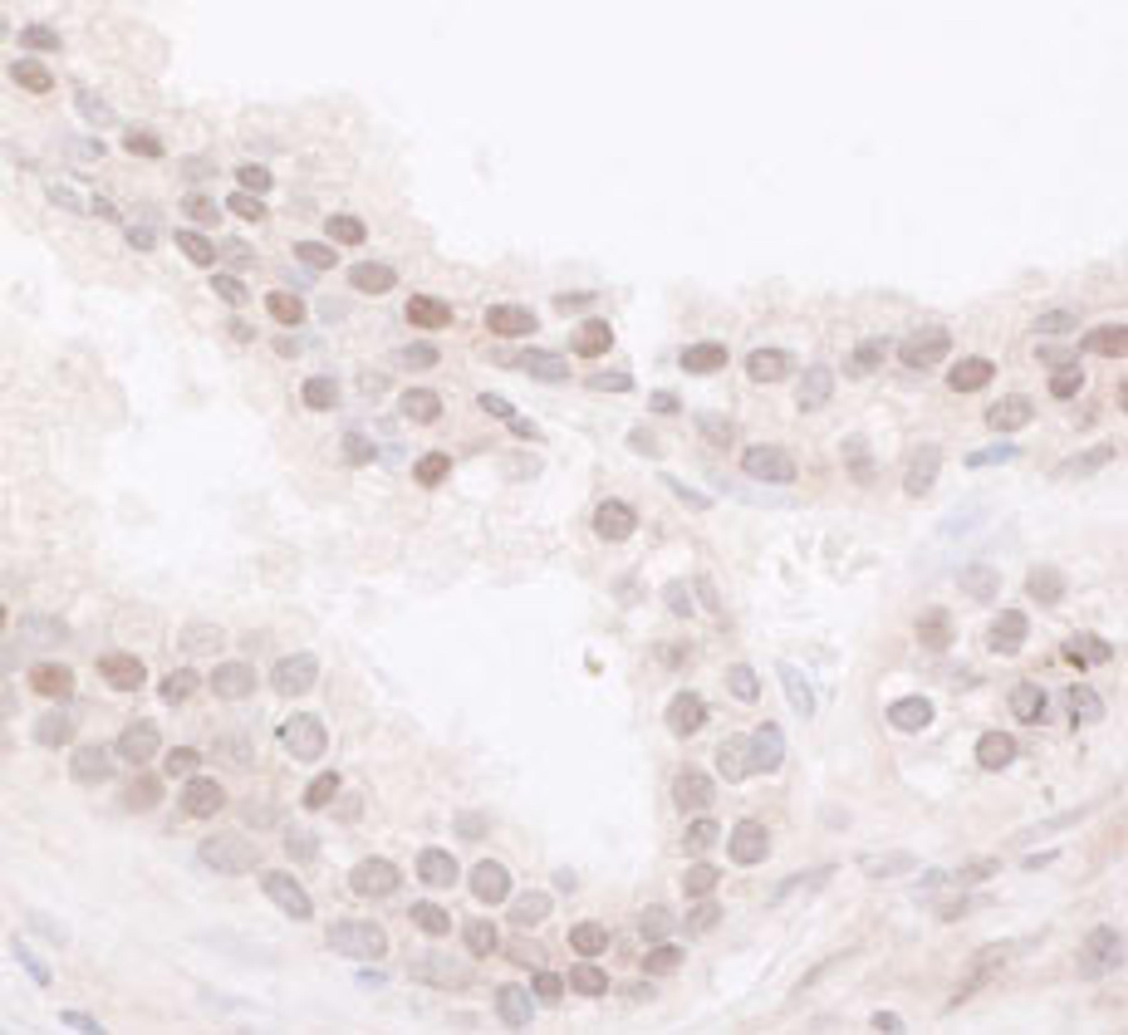 Detection of human JARID1B by immunohistochemistry.